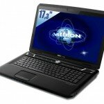 Medion Erazer X7813 17.3-Inch Gaming Laptop 1